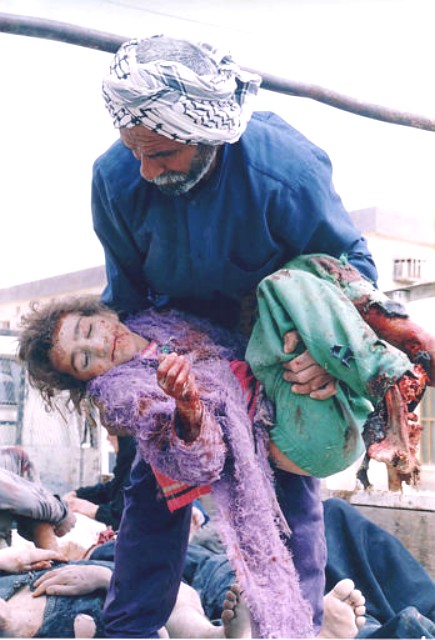 Irakisk pige lemlstet 
 
  
af amerikansk angreb